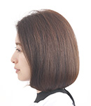 施術例ビフォー・アフター