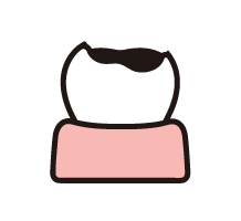 むし歯を防ぐ