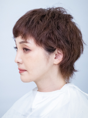 グレージュブラウン(GrB) 施術前(Before)の髪色状態
